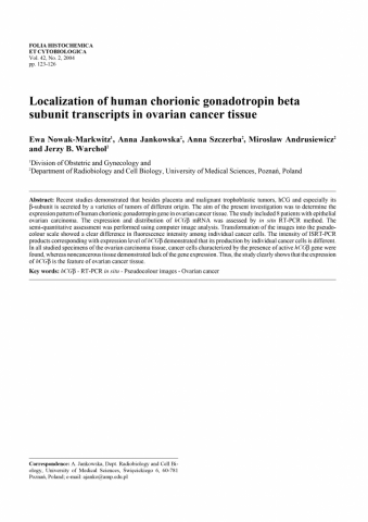 Localization of human chorionic gonadotropin beta subunit transcripts in ovarian cancer tissue.